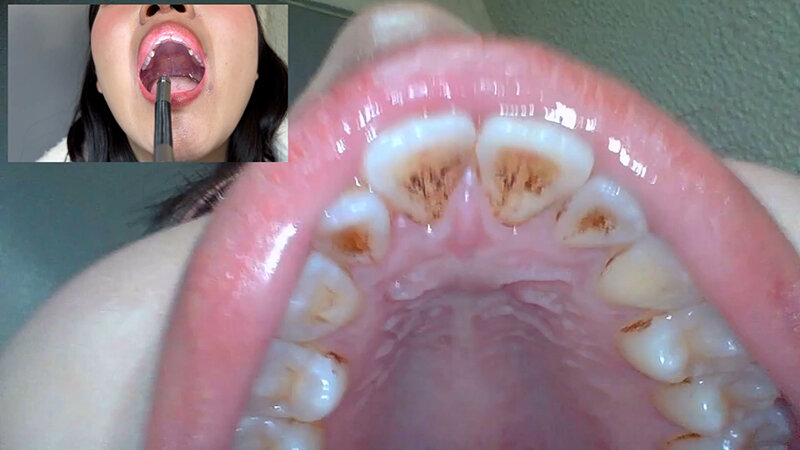 「【素人ナンパ】コールセンター勤務の美人お姉さんに街角で声かけ！口内観察に恥じらう姿が可愛すぎる」のサンプル画像13枚目