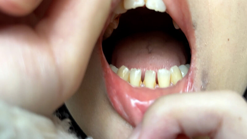 「【素人ナンパ】コールセンター勤務の美人お姉さんに街角で声かけ！口内観察に恥じらう姿が可愛すぎる」のサンプル画像6枚目