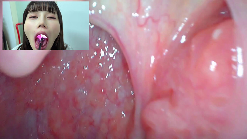 「【口腔観察】歯・舌・喉をじっくり接写！素人4名の口内フェチ動画55分セット」のサンプル画像3枚目