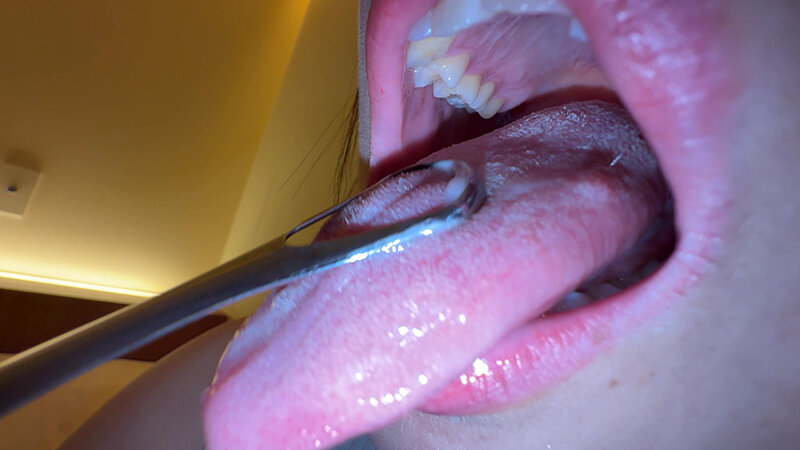 「【赤城穂波】素人お姉さんをナンパ！舌ブラシで汚舌苔採取する個人撮影動画」のサンプル画像14枚目