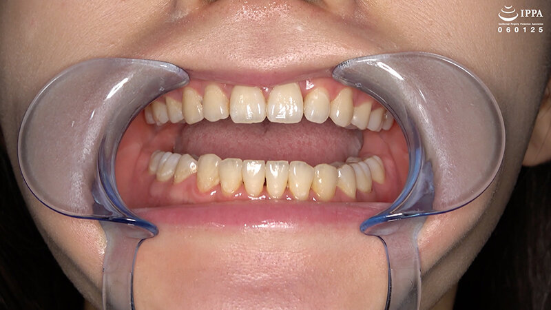 「横峯めぐの口内・歯・のどちんこ観察プレイ！清楚系美少女M女が魅せる貴重映像」のサンプル画像5枚目