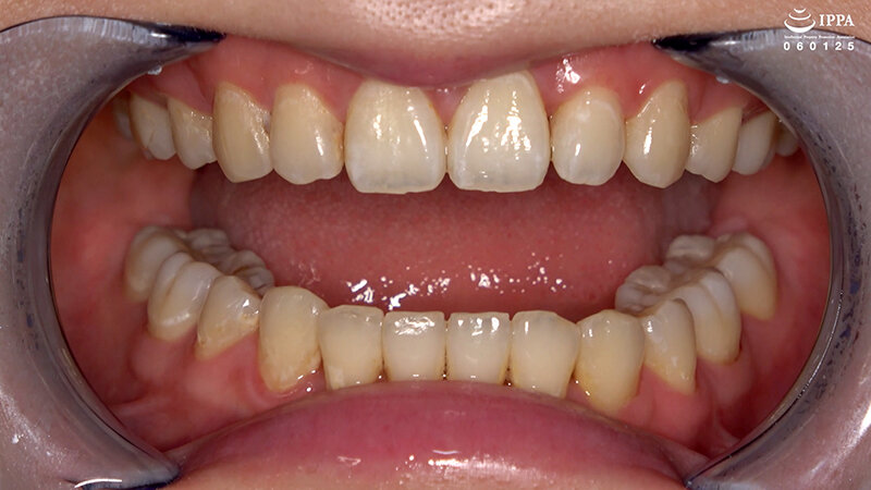 「横峯めぐの口内・歯・のどちんこ観察プレイ！清楚系美少女M女が魅せる貴重映像」のサンプル画像6枚目