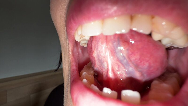 「【玉城夏帆】素人お姉さんをナンパ!舌ブラシで汚舌苔採取する個人撮影動画」のサンプル画像6枚目