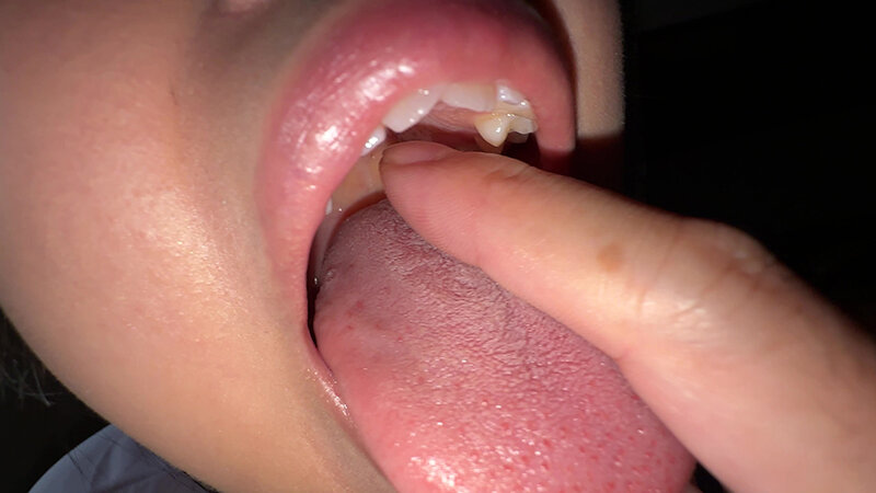 「【谷田かりな】素人お姉さんをナンパ!開口器で口内観察デカ舌チェック【個人撮影】」のサンプル画像12枚目