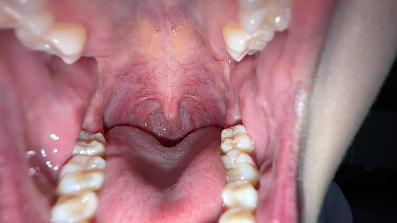 「【谷田かりな】素人お姉さんをナンパ!開口器で口内観察デカ舌チェック【個人撮影】」のサンプル画像3枚目