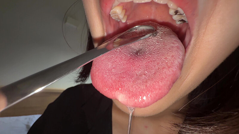 「【湊波流】素人お姉さんをナンパ!舌ブラシで汚舌苔採取する個人撮影動画」のサンプル画像12枚目