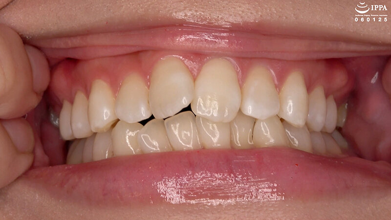 「【谷田かりな】口内観察＆巨大女フェチ動画！歯・口腔フェチ必見のくすぐったがり反応【フェチ】」のサンプル画像3枚目