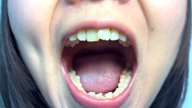 「【素人ナンパ】街角お姉さんみゆりちゃんの口内観察!テレビ局AD美女が恥じらい体験」のサンプル画像3枚目